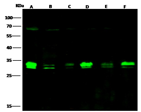 Recombinant BCL2L1/Bcl-XL Monoclonal Antibody - small - 2