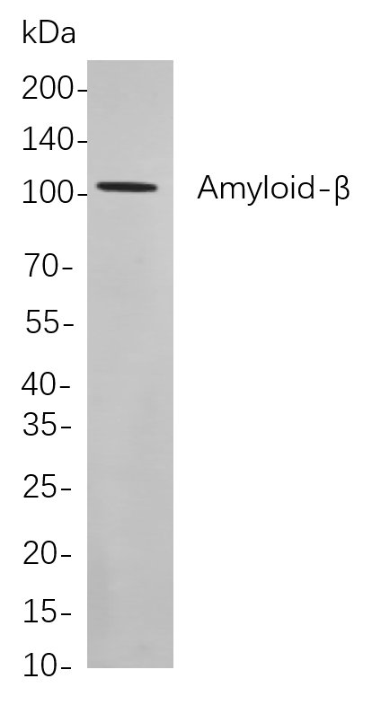 Recombinant Amyloid-β Monoclonal Antibody-searchlist-1