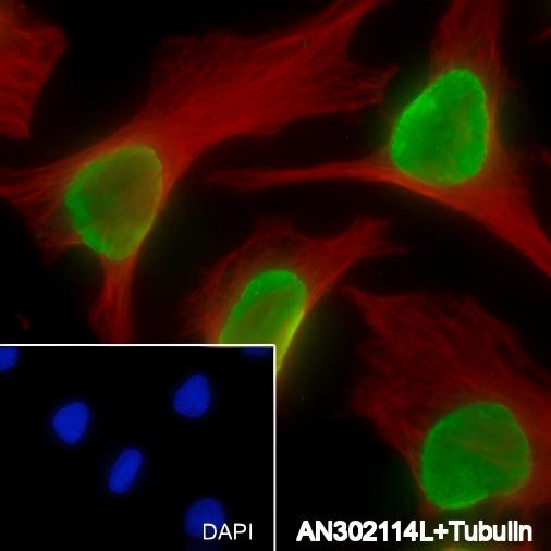 Recombinant Histone H4 (Mono Methyl Lys12) Monoclonal Antibody - small - 6