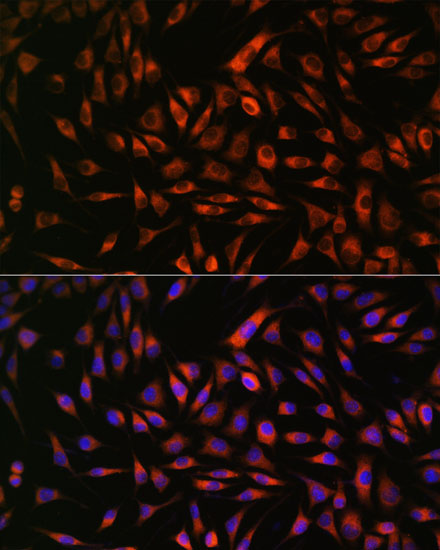 Immunofluorescence analysis of L929 cells using EML4 Polyclonal Antibody at dilution of  1:100. Blue: DAPI for nuclear staining.