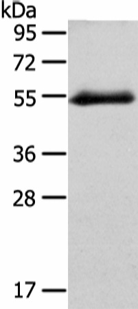 Western Blot analysis of Human placenta tissue using GLRA1 Polyclonal Antibody at dilution of 1/250