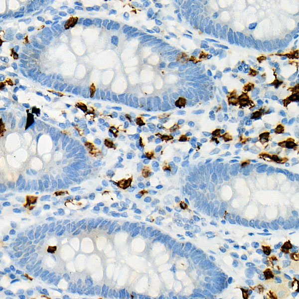 Immunohistochemistry of paraffin-embedded human colon using CD8A Polyclonal Antibody at dilution of 1:100 (40x lens).