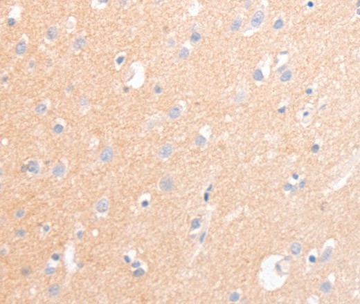 Immunohistochemistry of paraffin-embedded Human brain tissue using CD56 Polyclonal Antibody at dilution 1:30