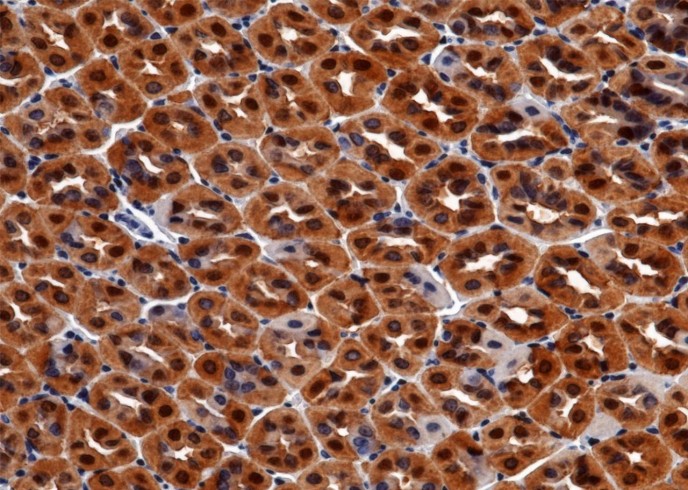 Recombinant Carbonic Anhydrase II/Car2 Monoclonal Antibody-searchlist-1