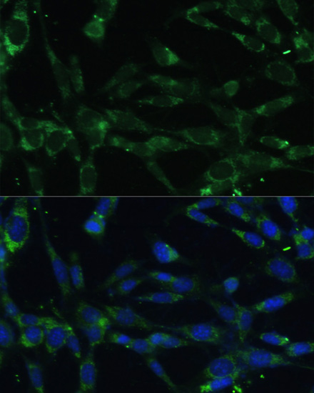 Immunofluorescence analysis of NIH-3T3 cells using CAPN5 Polyclonal Antibody at dilution of  1:100. Blue: DAPI for nuclear staining.