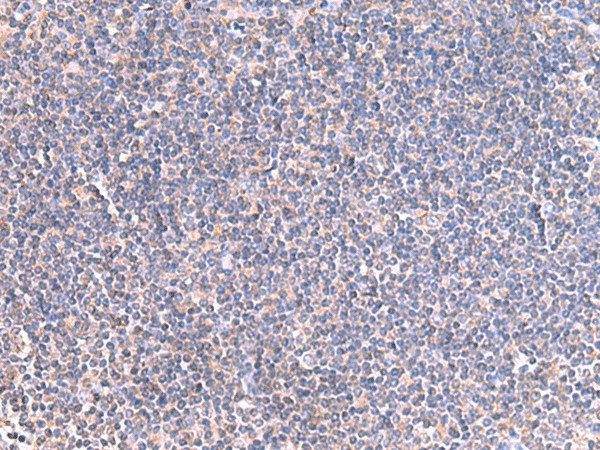 Immunohistochemistry of paraffin-embedded Human tonsil tissue  using GRIA2 Polyclonal Antibody at dilution of 1:40(?200)