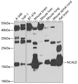 Western blot analysis of extracts of various cell lines using NCALD Polyclonal Antibody at 1:1000 dilution.