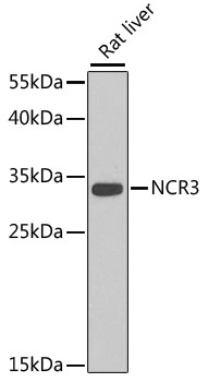 Western blot analysis of extracts of Rat liver using NCR3 Polyclonal Antibody at dilution of 1:1000.