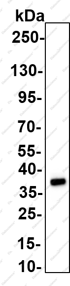 Recombinant HOXB13 Monoclonal Antibody - 3