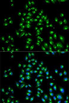 Immunofluorescence analysis of HeLa cells using USO1 Polyclonal Antibody