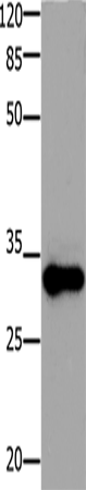 Western Blot analysis of Mouse testis tissue using ADO Polyclonal Antibody at dilution of 1:1200