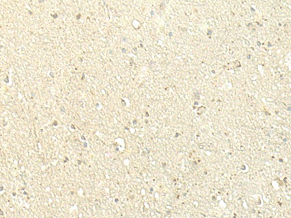 Immunohistochemistry of paraffin-embedded Human brain tissue  using SPIRE1 Polyclonal Antibody at dilution of 1:60(?200)