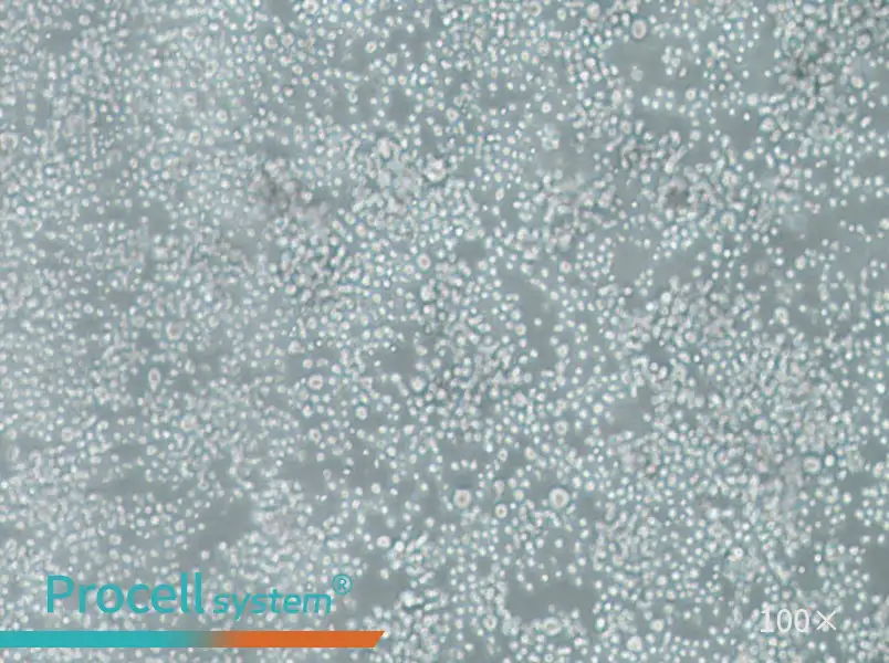 SU-DHL-2 Cell Complete Medium - 1