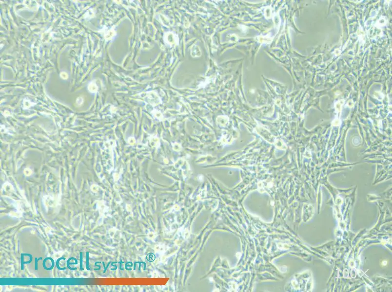 NCI-H1975 Cell Complete Medium - 2