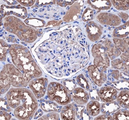 Recombinant Bcr Monoclonal Antibody - 3