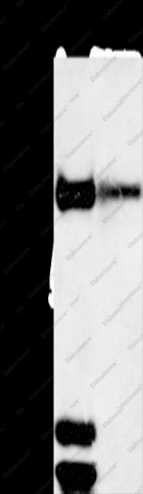 TRIM3 Polyclonal Antibody - 1