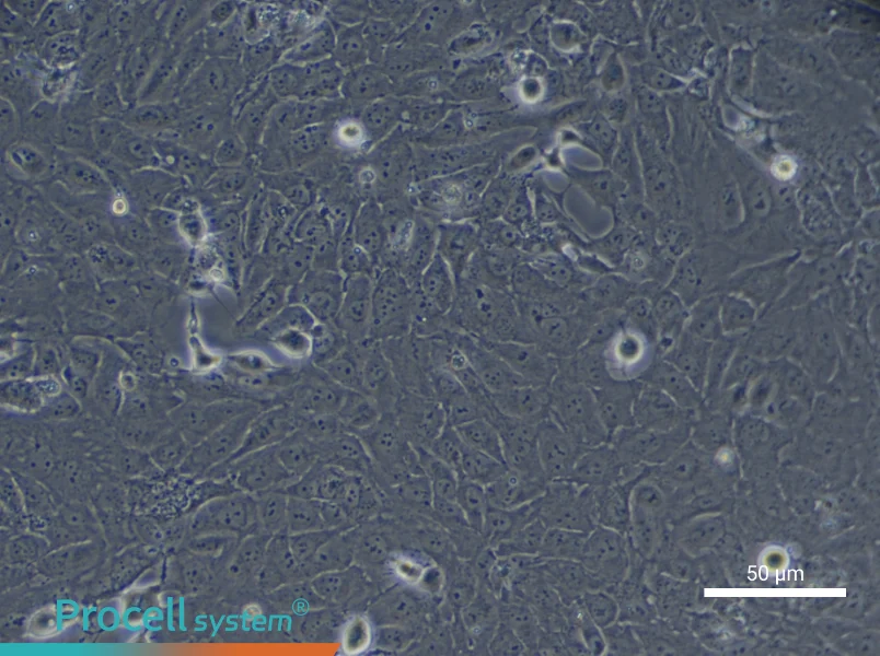 Human Type II Alveolar Epithelial (Primary cell immortalization) Cell Complete Medium - 11