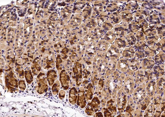 Recombinant Growth Hormone Receptor/GHR/GHBP Monoclonal Antibody-searchlist-1