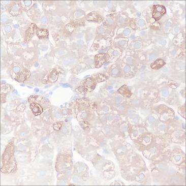 Recombinant FASN Monoclonal Antibody - small - 5