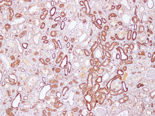 Immunohistochemistry of paraffin-embedded Rat kidney using Sptan1 Polyclonal Antibody at dilution of 1:100 (100 x)