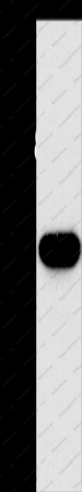 HOXB13 Polyclonal Antibody - 1