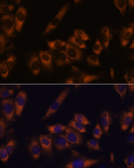 Immunofluorescence analysis of C6 cells using GRID2 Polyclonal Antibody at dilution of 1:100. Blue: DAPI for nuclear staining.