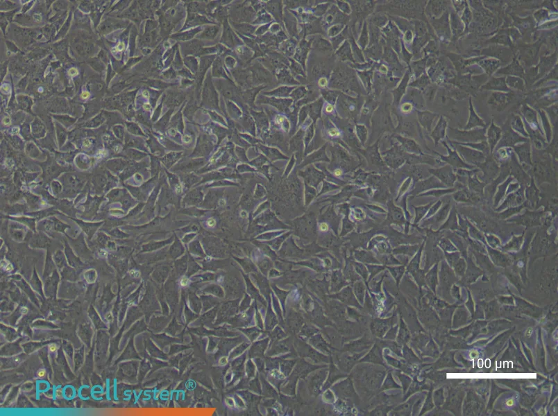 Mouse Cardiac Microvascular Pericytes - 1