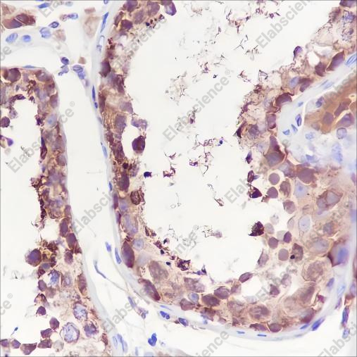 Recombinant LysRS Monoclonal Antibody - 2