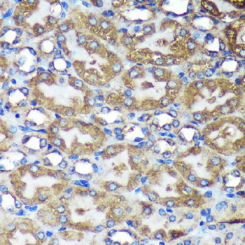 Immunohistochemistry of paraffin-embedded Mouse kidney using ACTR1B Polyclonal Antibody at dilution of 1:100 (40x lens).Perform microwave antigen retrieval with 10 mM PBS buffer pH 7.2 before commencing with IHC staining protocol.