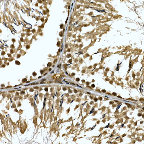 Immunohistochemistry of paraffin-embedded rat testis using ZNF213 Polyclonal Antibody at dilution of 1:100 (40x lens).Perform high pressure antigen retrieval with 10 mM citrate buffer pH 6.0 before commencing with IHC staining protocol.