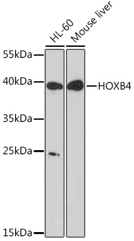 Western blot analysis of extracts of various cell lines using HOXB4 Polyclonal Antibody at1:1000 dilution.