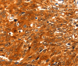 SERPINB5 Polyclonal Antibody - 2