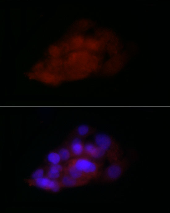 Immunofluorescence analysis of HepG2 cells using TIA1 Polyclonal Antibody at dilution of 1:100 (40x lens). Blue: DAPI for nuclear staining.