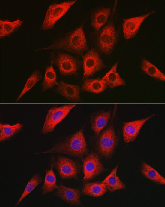 Immunofluorescence analysis of NIH/3T3 cells using [KO Validated] AMPKα2 Polyclonal Antibody at dilution of 1:100 (40x lens). Blue:DAPI for nuclear staining.