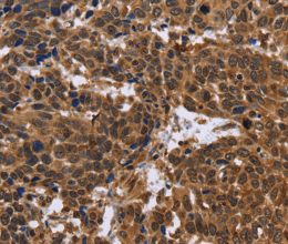 EDN2 Polyclonal Antibody - 2