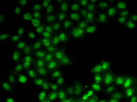 Immunofluorescence analysis of U2OS cells using C11orf30 Polyclonal Antibody