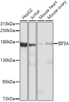 Western blot analysis of extracts of various cell lines using EIF3A Polyclonal Antibody at 1:1000 dilution.