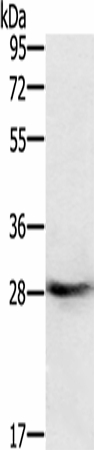 Western Blot analysis of Human normal colon tissue using RAB8B Polyclonal Antibody at dilution of 1:400