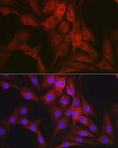 Immunofluorescence analysis of NIH-3T3 cells using Mineralocorticoid receptor Polyclonal Antibody at dilution of 1:100 (40x lens). Blue: DAPI for nuclear staining.