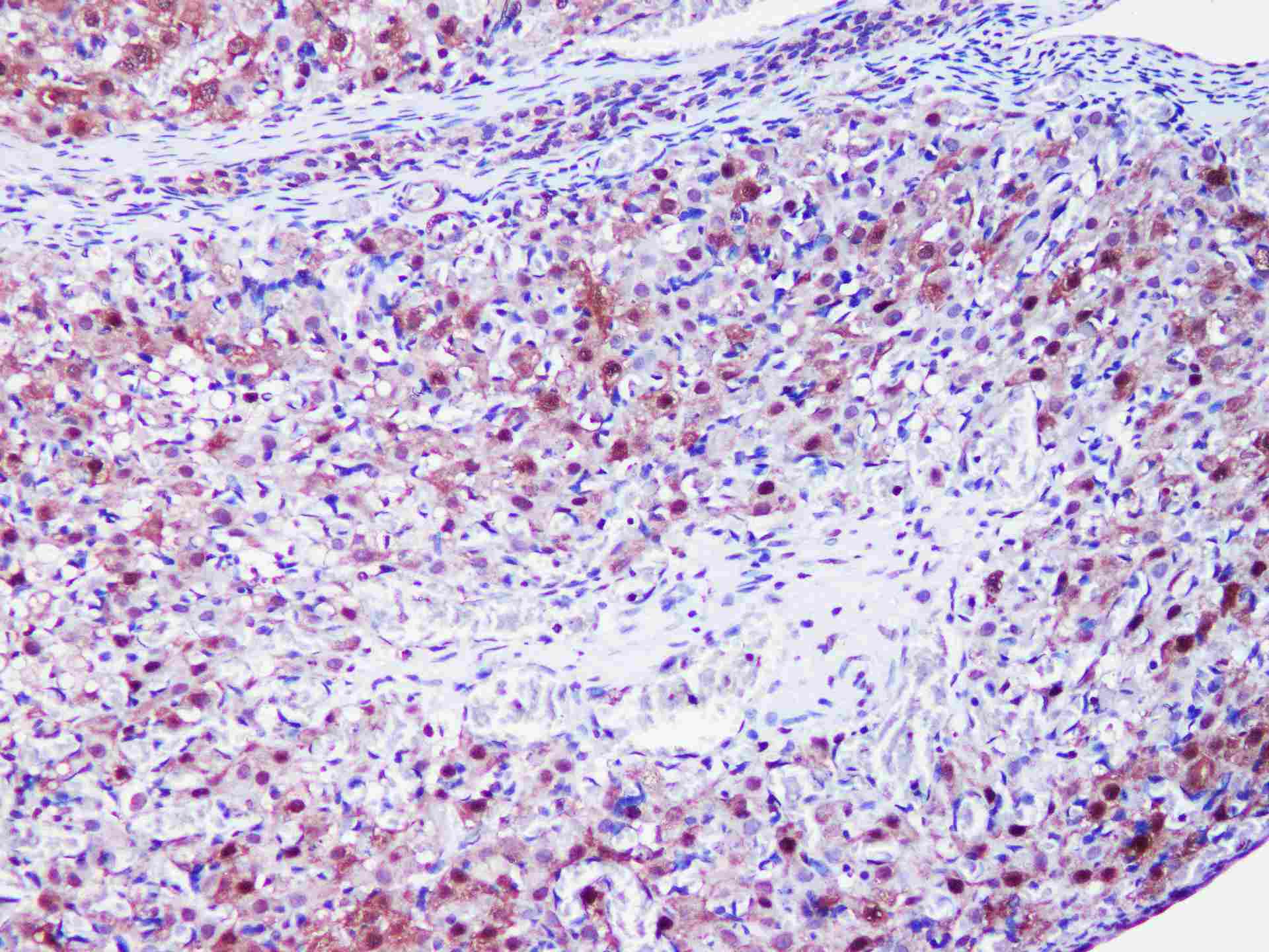 GAPDH Monoclonal Antibody - small - 4