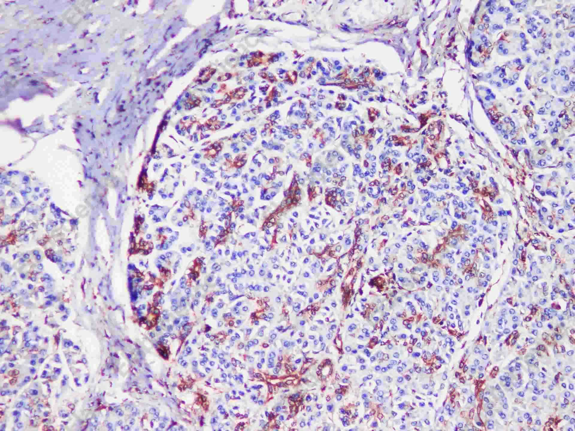 S100A11 Polyclonal Antibody - 3