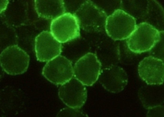 Recombinant CD6/Cluster of Differentiation 6 Monoclonal Antibody-searchlist-1