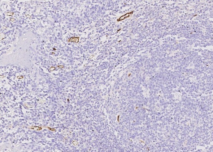 Endoglin/CD105 Monoclonal Antibody - small - 2