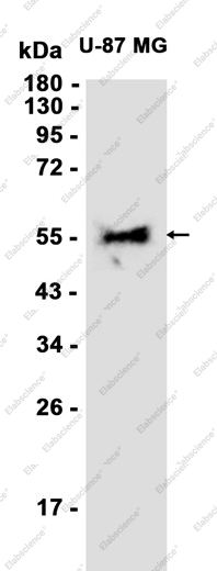 Recombinant Retinoic Acid Receptor beta Monoclonal Antibody - 1