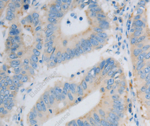 PDX1 Polyclonal Antibody - 2