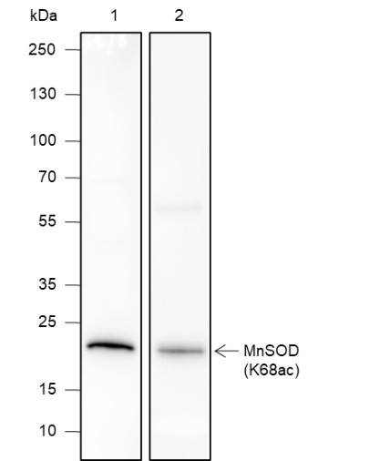 Recombinant SOD2 (Acetyl Lys68) Monoclonal Antibody-searchlist-1