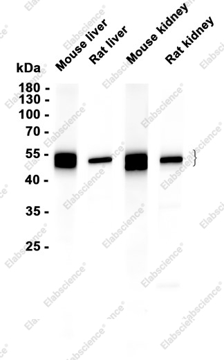 Recombinant CYP4A11 Monoclonal Antibody - 1