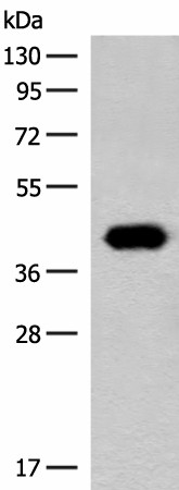 Western blot analysis of Hela cell lysate  using GIPC1 Polyclonal Antibody at dilution of 1:400