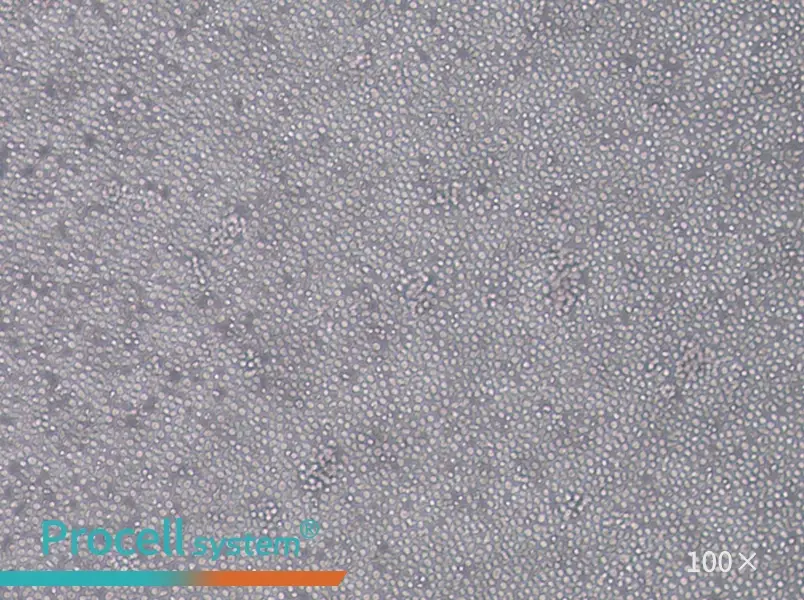 MOLT-4 Cell Complete Medium - 2