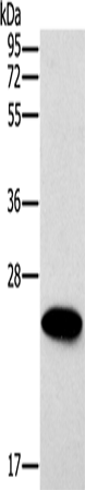 Western Blot analysis of Mouse heart tissue using ERAS Polyclonal Antibody at dilution of 1:500